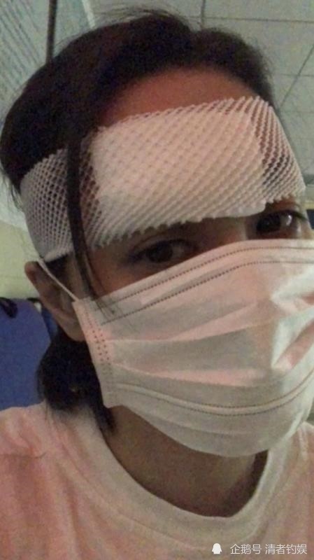 %title插图%num 阿娇或需再做手术-WordPress极简博客