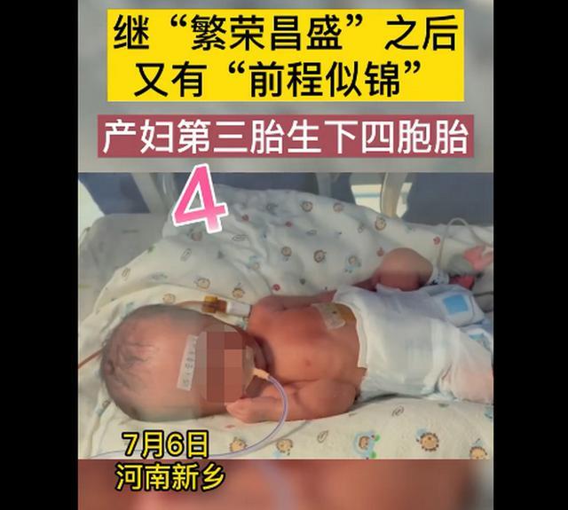 %title插图%num 新乡一产妇第三胎生下龙凤四胞胎-WordPress极简博客