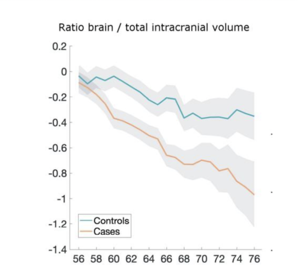 新冠或致大脑萎缩 使人提前老10岁-WordPress极简博客